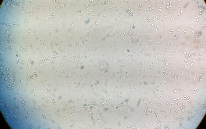 Microscopic View of Wild Yeast and Bacteria in Sourdough